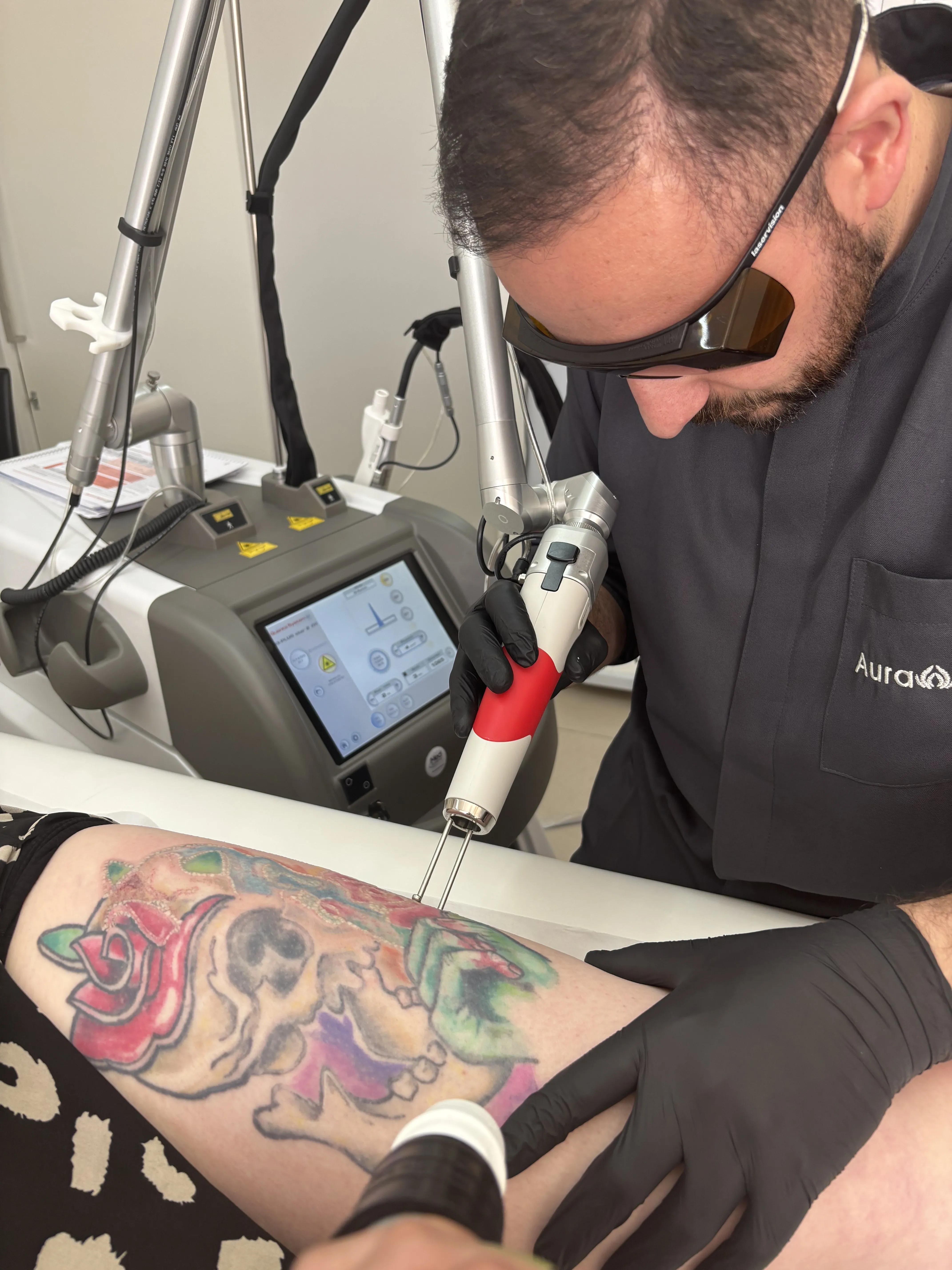 Elvio Rossetto aplicando laser em uma tatuagem colorida
