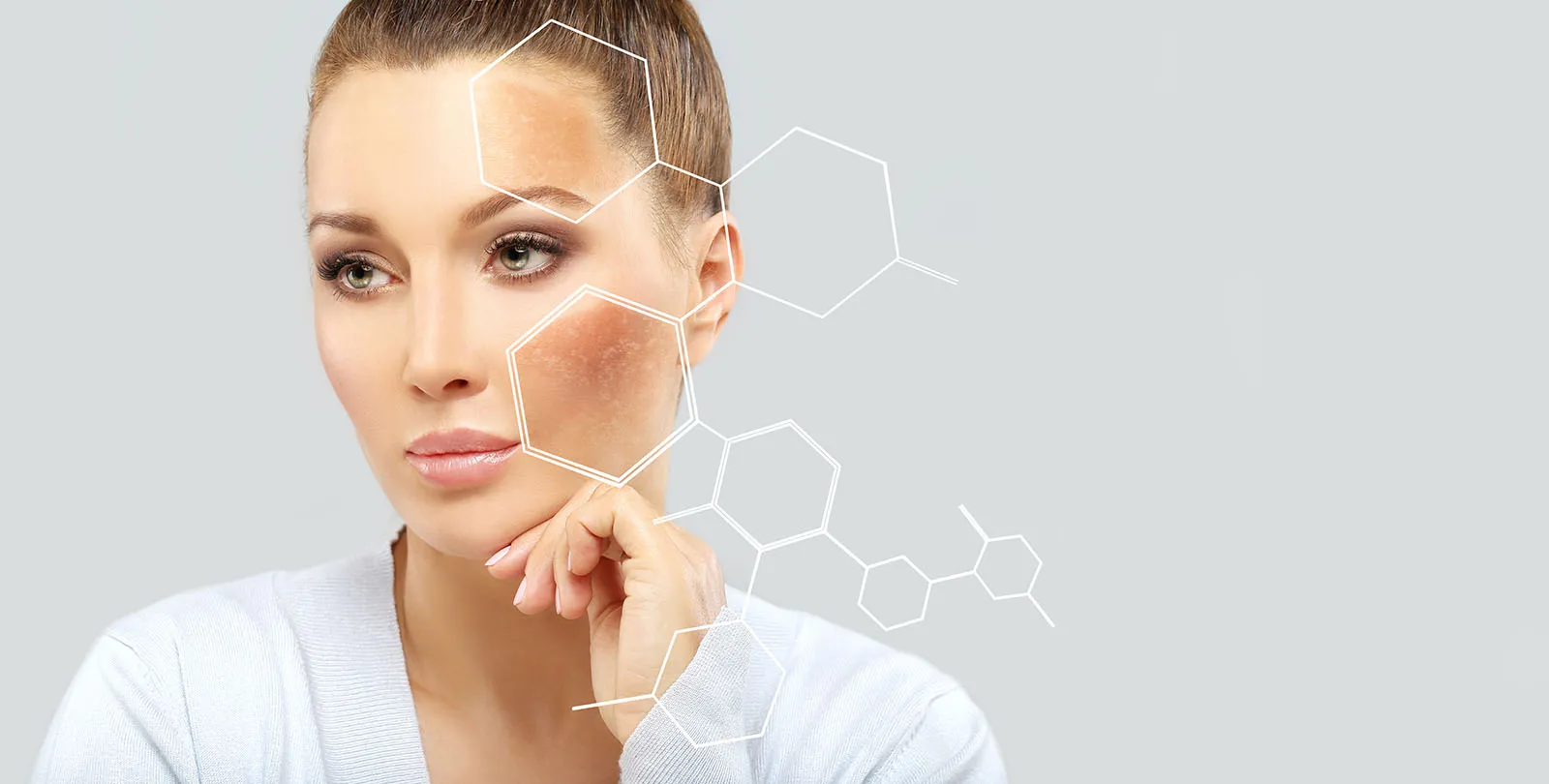 Rosto feminino com áreas de pigmentação facial destacadas de forma ilustrativa
